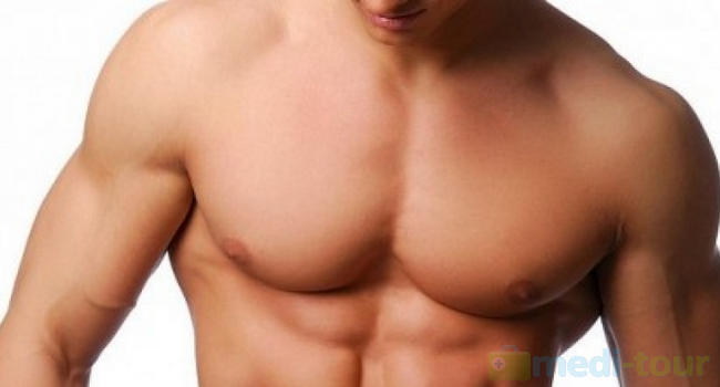 Powiększanie klatki piersiowej implantami mięsni piersiowych dla mężczyzn
