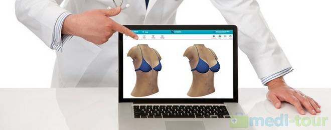 Symulacja powiększania piersi 3D Crisalix